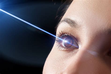 poggibonsi laser occhi